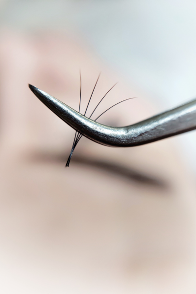 Ingrown Hair Removal Service provided by derma laser and aesthetic clinic in Sandton