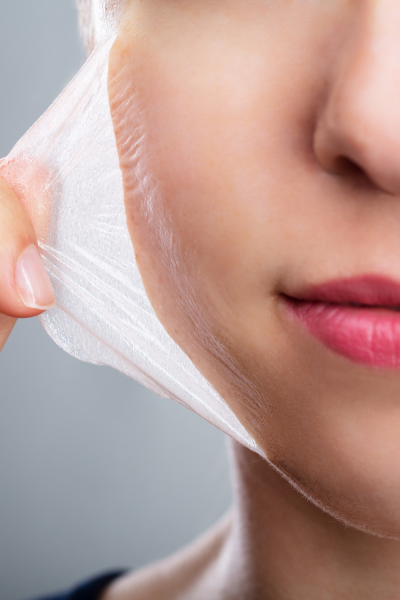 taking off the micro peel from the face